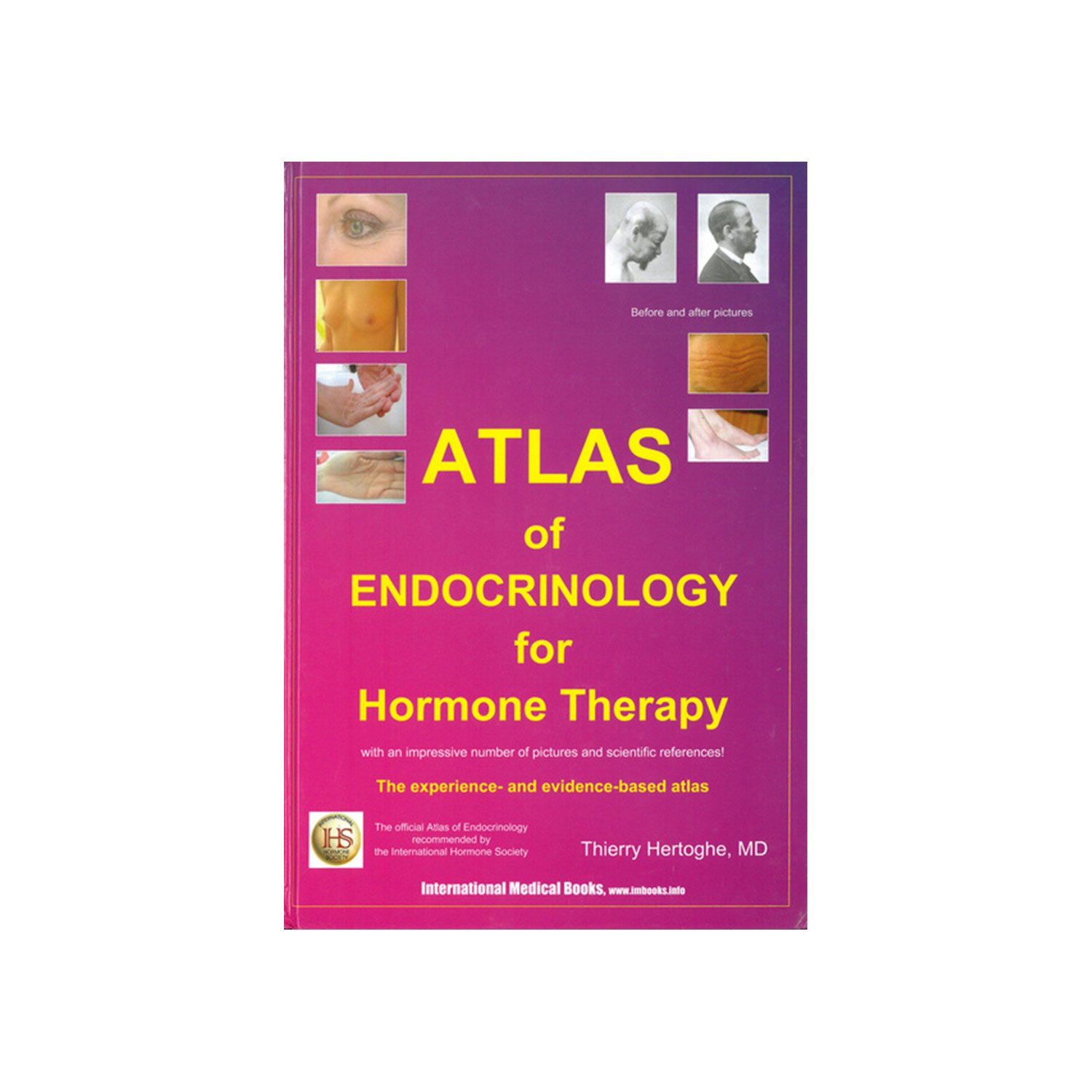 Atlas of Endocrinology for Hormone Therapy By Dr Thierry Hertoghe MD